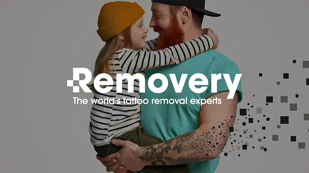 Removery Tattoo Removal & Fading — Tattoo removal service in Hermosa Beach