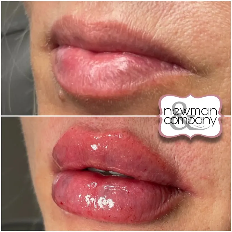 Newman & Company — Medical spa in New Braunfels