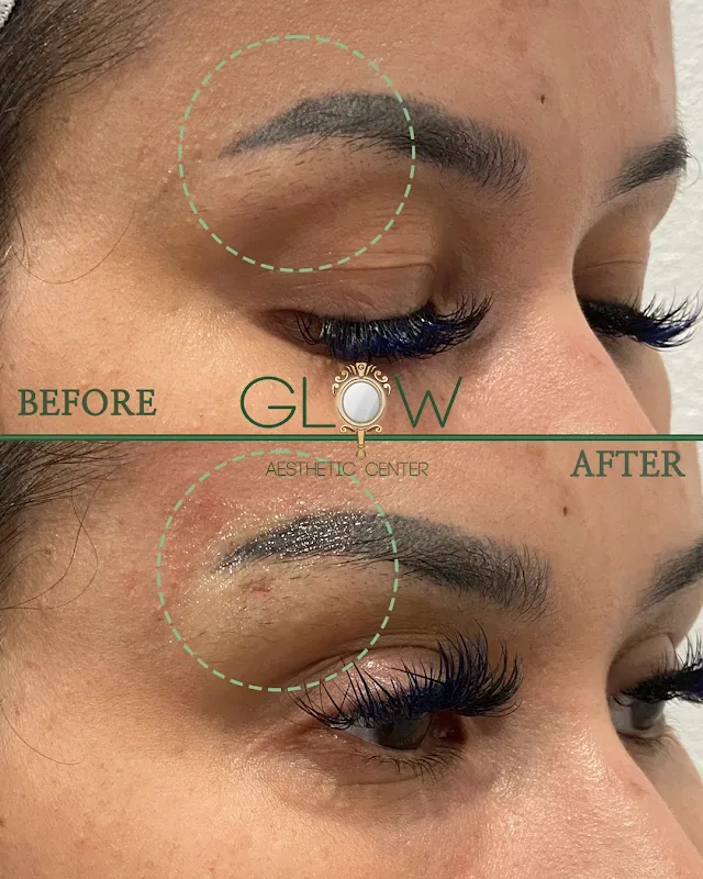 Glow Aesthetic Center Med Spa — Medical spa in Encino